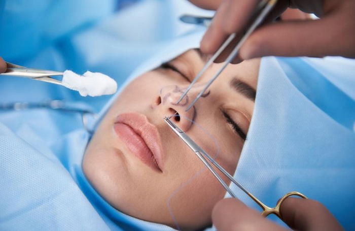 Nâng Mũi Bọc Sụn