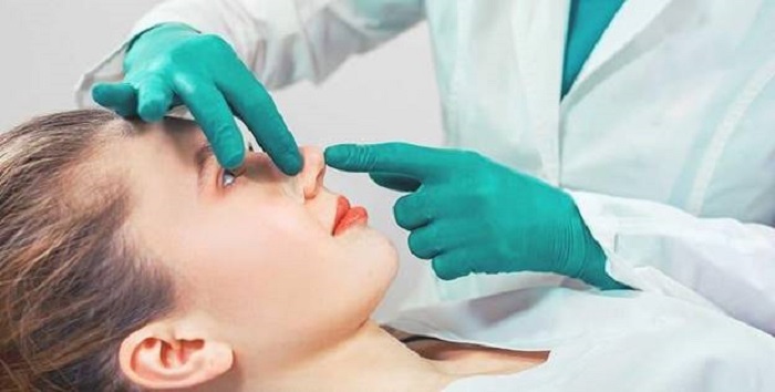 Nâng Mũi Cấu Trúc