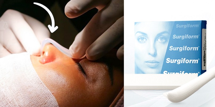Nâng Mũi Sụn Surgiform