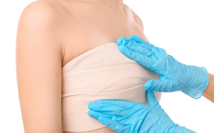 Phẫu thuật ngực cho người chuyển giới