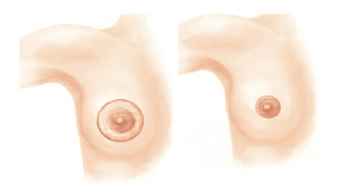 Thu Nhỏ Quầng Vú