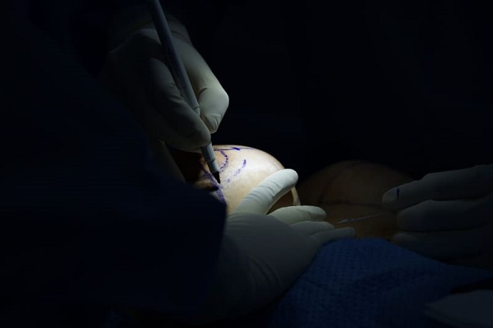 Thu Nhỏ Quầng Vú