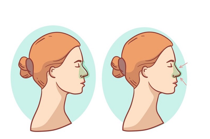 Thu Gọn Cánh Mũi